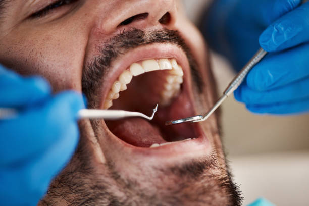 Best Broken or Chipped Tooth Repair in Riverside, CT