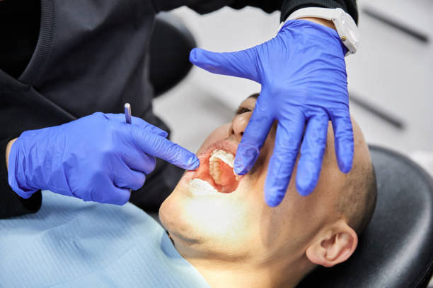 Best Broken or Chipped Tooth Repair in Riverside, CT